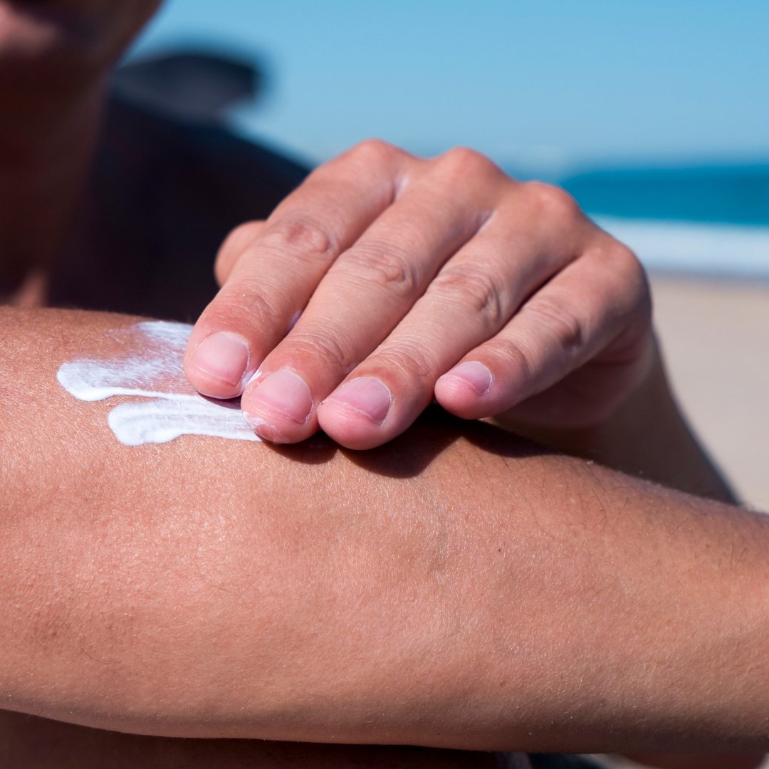 3 Tips to Keep Your Skin from Getting Sunburnt This Summer - Dude-Skin